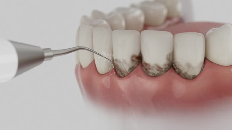 Trusted Teeth Cleaning And Checkup service in Bethany, IL - Dentist Open Now